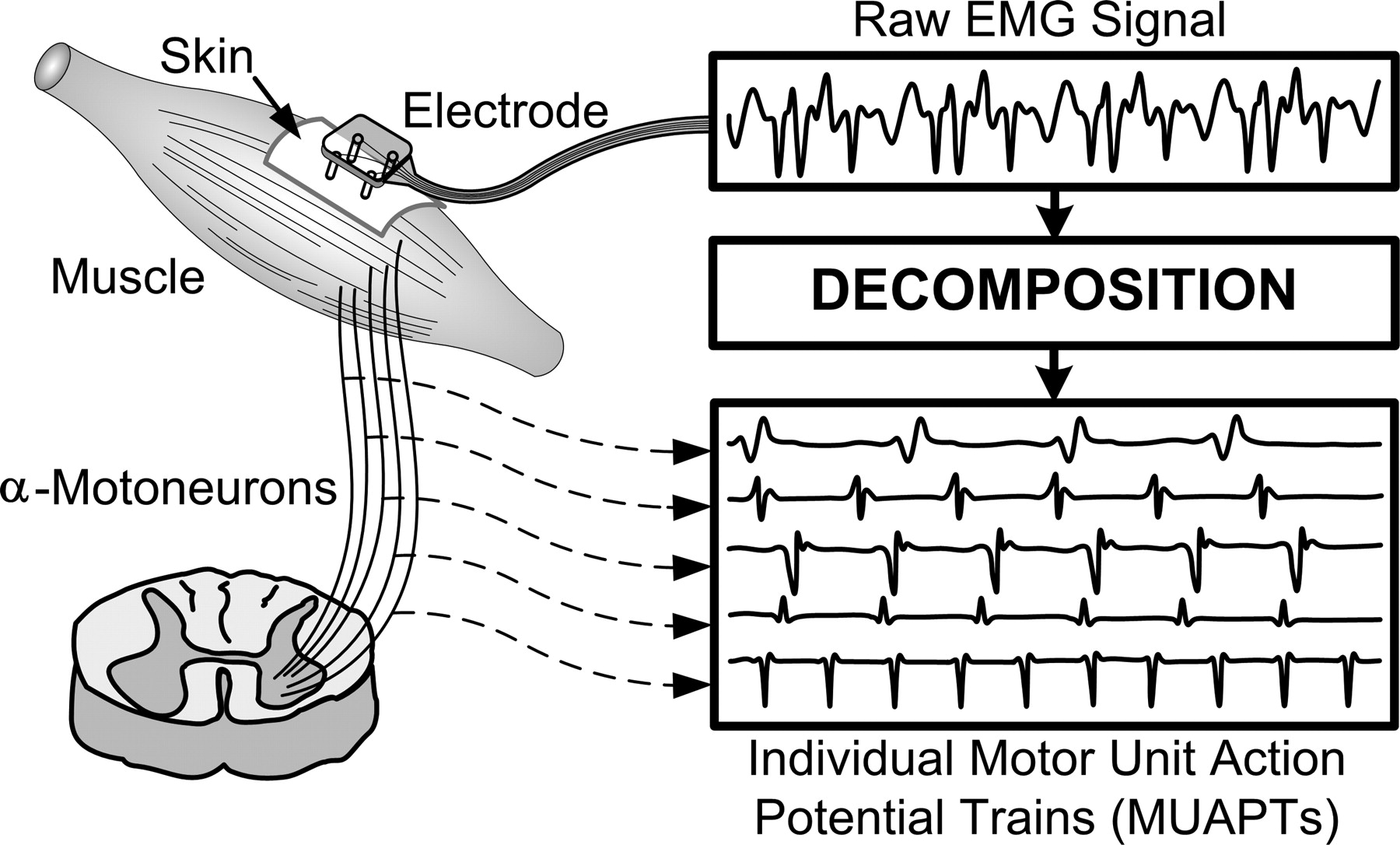 Motor unit action potential representation (figure from De Luca et al., 2006).